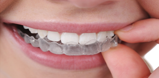 Dental Clinic Clear Aligners