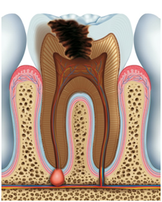 32 Smile Stone Functioning in Mouth 32 Smile Stone Functioning in Mouth